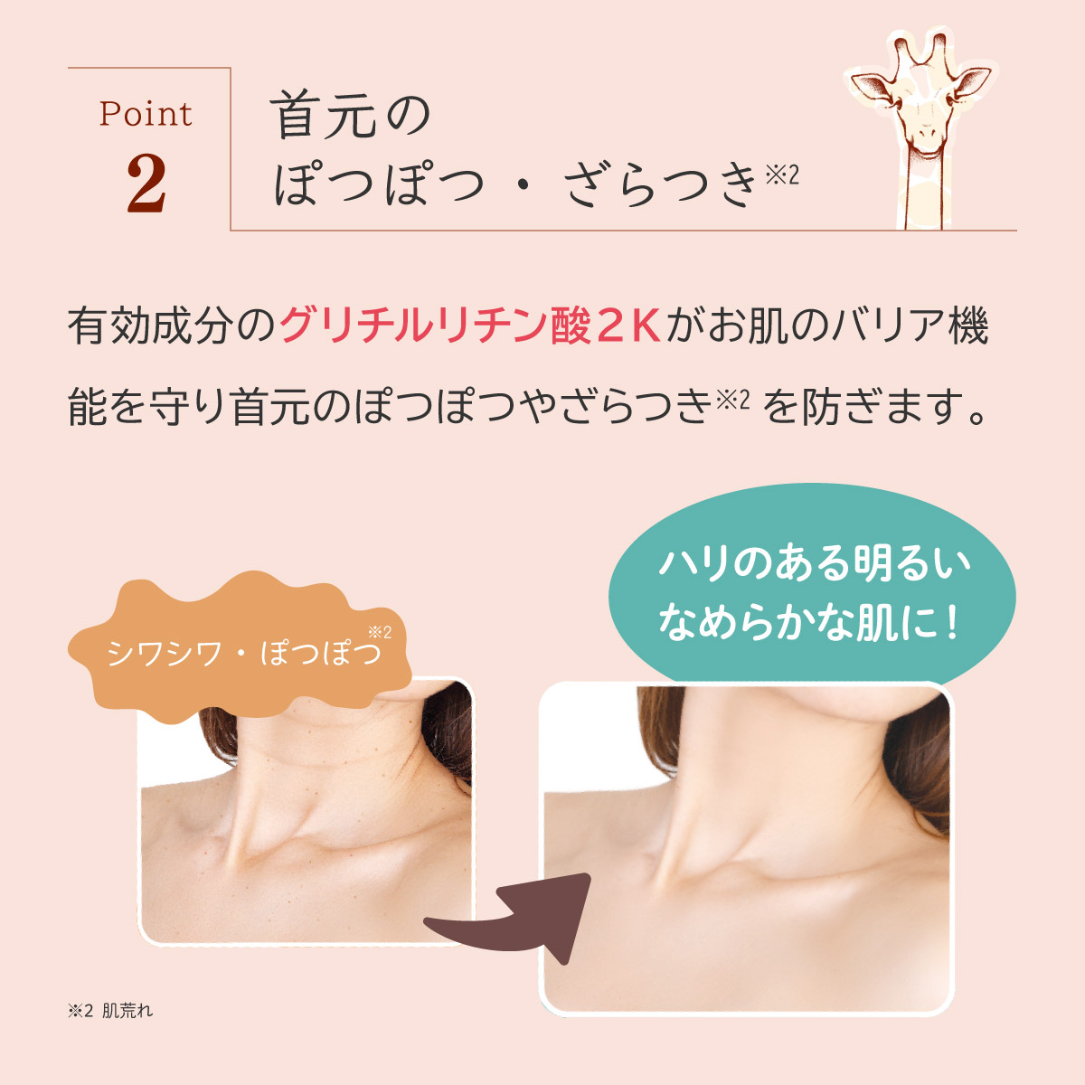 Point 2) 颈部的斑点和粗糙